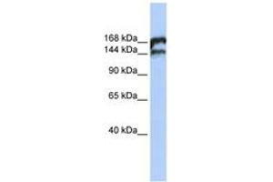 Image no. 1 for anti-Topoisomerase (DNA) II beta 180kDa (TOP2B) (AA 1548-1597) antibody (ABIN6742741) (TOP2B Antikörper  (AA 1548-1597))