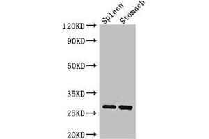 Western Blot Positive WB detected in: Mouse spleen tissue, Mouse stomach tissue All lanes: CTRB1 antibody at 3 μg/mL Secondary Goat polyclonal to rabbit IgG at 1/50000 dilution Predicted band size: 28 kDa Observed band size: 28 kDa (CTRB1 Antikörper  (AA 19-263))