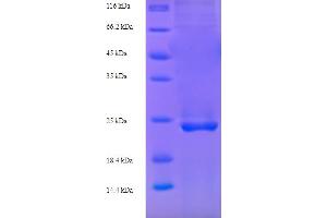 CAMK2N1 Protein (AA 1-78, full length) (His-SUMO Tag)