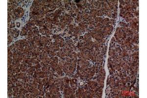 Immunohistochemistry (IHC) analysis of paraffin-embedded Human Pancreas, antibody was diluted at 1:100.