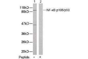 Image no. 2 for anti-Nuclear Factor of kappa Light Polypeptide Gene Enhancer in B-Cells 1 (NFKB1) (Ser893) antibody (ABIN197124) (NFKB1 Antikörper  (Ser893))