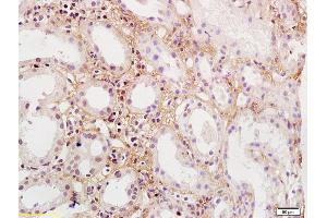 Formalin-fixed and paraffin embedded human kidney labeled with Rabbit Anti-PDGFBB Polyclonal Antibody, Unconjugated  at 1:200 followed by conjugation to the secondary antibody and DAB staining, (PDGF-BB Homodimer (AA 151-241) Antikörper)