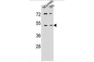 UNQ9391 Antibody (C-term) western blot analysis in NCI-H460,293 cell line lysates (35 µg/lane).