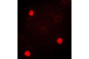Immunofluorescent analysis of TIA1 staining in SKOV3 cells.