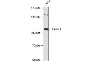 Western blot analysis of extracts of HeLa cells, using C Antibody (ABIN6127547, ABIN6137919, ABIN6137921 and ABIN6215925) at 1:3000 dilution. (Calpain 3 Antikörper  (AA 1-150))