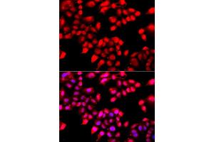 Immunofluorescence analysis of A549 cells using XRCC6 antibody. (XRCC6 Antikörper)