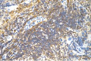 Immunohistochemistry was performed on paraffin-embedded mouse spleen using NFKB1 antibody (ABIN7799638), 1:200).