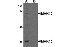 Western Blotting (WB) image for anti-MAK10 Homolog, Amino-Acid N-Acetyltransferase Subunit (MAK10) (N-Term) antibody (ABIN1031448) (MAK10/NAA35 Antikörper  (N-Term))