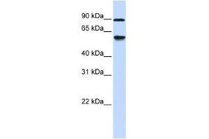 ADHFE1 antibody used at 1 ug/ml to detect target protein.