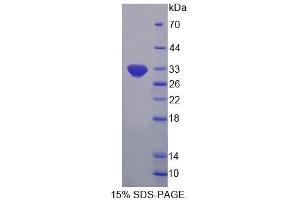 Image no. 1 for 2'-5'-Oligoadenylate Synthetase-Like (OASL) (AA 2-244) protein (His tag) (ABIN6237464)
