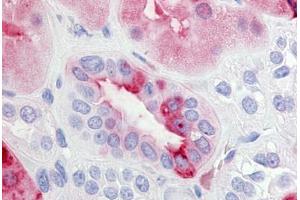 anti-Prostaglandin E Receptor 2 (Subtype EP2), 53kDa (PTGER2) (C-Term) antibody