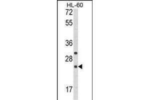 Western blot analysis of RGS1 Antibody (N-term) (ABIN652704 and ABIN2842468) in HL-60 cell line lysates (35 μg/lane).