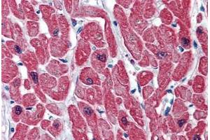 Human Heart: Formalin-Fixed, Paraffin-Embedded (FFPE) (TNNI3 Antikörper  (AA 102-211))