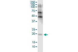 FLJ35767 monoclonal antibody (M03), clone 2F3. (FLJ35767 (AA 1-164) Antikörper)