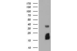 Western Blotting (WB) image for anti-Ephrin A2 (EFNA2) antibody (ABIN1497955) (Ephrin A2 Antikörper)