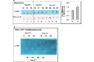 Chronic oxycodone treatment increases protein carbonyl content in rat plasma. (Dinitrophenol Antikörper)