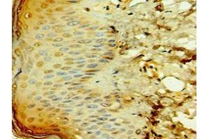 Immunohistochemistry of paraffin-embedded human skin tissue using ABIN7171674 at dilution of 1:100 (TCTN2 Antikörper  (AA 420-670))