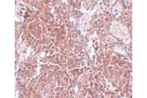 Immunohistochemistry (IHC) image for anti-Tetraspanin 9 (TSPAN9) (Middle Region) antibody (ABIN1031151)