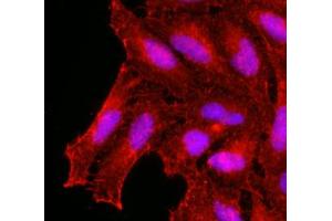Immunofluorescence of human HeLa cells stained with monoclonal anti-human KCDT15 antibody (1:500) with Texas Red (Red). (KCTD15 Antikörper  (AA 1-234))
