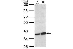 WB Image Sample (30 ug of whole cell lysate) A: Molt-4 , B: Raji 10% SDS PAGE antibody diluted at 1:1000 (ACMSD Antikörper)