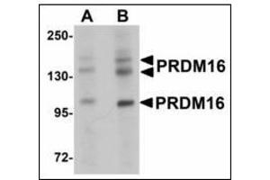Western blot analysis of PRDM16 in rat brain tissue lysate with after heat-induced antigen retrieval at (A) 1 and (B) 2 µg/ml. (PRDM16 Antikörper  (C-Term))