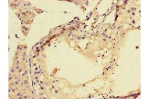 Immunohistochemistry of paraffin-embedded human testis tissue using ABIN7173726 at dilution of 1:100 (TPPP3 Antikörper  (AA 2-176))