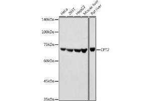 Western blot analysis of extracts of various cell lines, using CPT2 antibody (ABIN6129249, ABIN6138983, ABIN6138984 and ABIN6216045) at 1:1000 dilution. (CPT2 Antikörper  (AA 1-180))