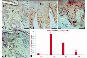 The effects of ustekinumab and CUC on PCNA IE in IQ-induced psoriatic skin lesions. (PCNA Antikörper)