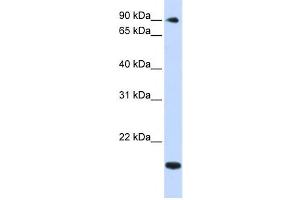 Western Blotting (WB) image for anti-TSR1, 20S rRNA Accumulation, Homolog (TSR1) antibody (ABIN2459005) (TSR1 Antikörper)