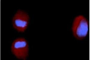 Immunofluorescence (IF) image for anti-Fibroblast Growth Factor 2 (Basic) (FGF2) (AA 143-288) antibody (PE) (ABIN5565476) (FGF2 Antikörper  (AA 143-288) (PE))