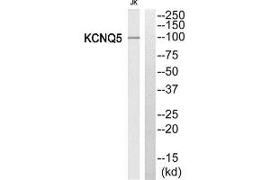 Western Blotting (WB) image for anti-Potassium Voltage-Gated Channel, KQT-Like Subfamily, Member 5 (KCNQ5) (Internal Region) antibody (ABIN1851853) (KCNQ5 Antikörper  (Internal Region))