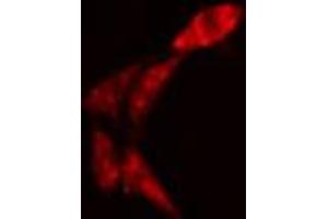 ABIN6274326 staining Hela cells by IF/ICC. (AKAP13 Antikörper  (Internal Region))