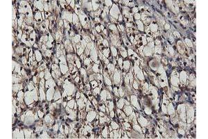 Image no. 3 for anti-V-Akt Murine Thymoma Viral Oncogene Homolog 1 (AKT1) antibody (ABIN1496556) (AKT1 Antikörper)