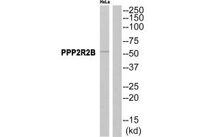 Western blot analysis of extracts from HeLa cells, using PPP2R2B antibody. (PPP2R2B Antikörper  (Internal Region))