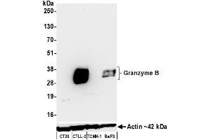 Western Blotting (WB) image for anti-Granzyme B (GZMB) (C-Term) antibody (ABIN7795631)