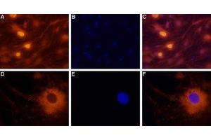 Expression of neuropeptide Y2 receptor in rat dorsal root ganglion cells - Immunocytochemical staining of rat dorsal root ganglion (DRG) neurons. (NPY2R Antikörper  (Intracellular))