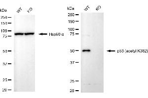 Western blotting analysis using p53 (acetyl K382) antibody (ABIN7800683).