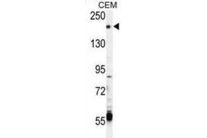 Western Blotting (WB) image for anti-Transient Receptor Potential Cation Channel, Subfamily M, Member 6 (TRPM6) antibody (ABIN3003652) (TRPM6 Antikörper)