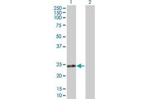 Western Blot analysis of RPIA expression in transfected 293T cell line by RPIA MaxPab polyclonal antibody.