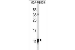 Western blot analysis in MDA-MB435 cell line lysates (35ug/lane). (NDUFAB1 Antikörper  (C-Term))