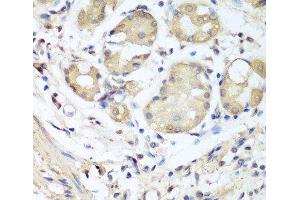 Immunohistochemistry of paraffin-embedded Human stomach using NID1 Polyclonal Antibody at dilution of 1:100 (40x lens). (Nidogen 1 Antikörper)
