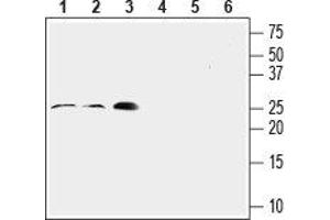 Western blot analysis of rat lung (lanes 1 and 4, 1:200), mouse heart (lanes 2 and 5, 1:200) and rat aortic endothelial cell (RAEC) (lanes 3 and 6, 1:400) lysates: - 1-3. (RAMP2 Antikörper  (Extracellular, N-Term))