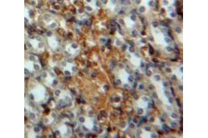 IHC-P analysis of Kidney tissue, with DAB staining. (IRF3 Antikörper  (AA 1-360))