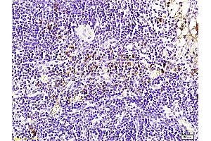 Formalin-fixed and paraffin embedded rabbit pancreas labeled with Anti-Bcl-2 Polyclonal Antibody, Unconjugated (ABIN707156) followed by conjugation to the secondary antibody and DAB staining (Bcl-2 Antikörper  (AA 161-239))
