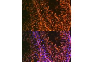 Immunofluorescence analysis of rat testis using Lin28 Rabbit mAb (ABIN7268266) at dilution of 1:100 (40x lens). (LIN28A Antikörper)