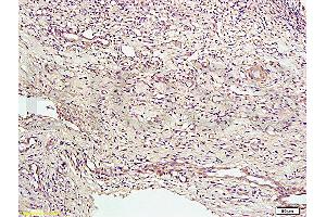Formalin-fixed and paraffin embedded rat bile duct tissue labeled with Anti-CD34 Polyclonal Antibody, Unconjugated (ABIN676898) at 1:200 followed by conjugation to the secondary antibody and DAB staining (CD34 Antikörper  (AA 201-300))
