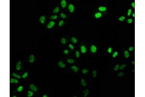 Immunofluorescence staining of Hela cells with ABIN7127487 at 1:25, counter-stained with DAPI. (Rekombinanter FEN1 Antikörper)