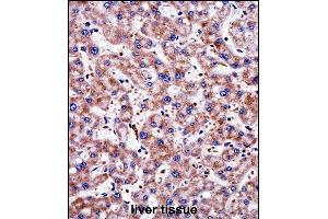 TAGLN2 Antibody (C-term) ((ABIN657984 and ABIN2846931))immunohistochemistry analysis in formalin fixed and paraffin embedded human liver tissue followed by peroxidase conjugation of the secondary antibody and DAB staining. (TAGLN2 Antikörper  (C-Term))