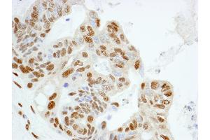Immunohistochemistry (IHC) image for anti-Karyopherin (Importin) alpha 4 (KPNA4) (AA 471-521) antibody (ABIN7448983) (KPNA4 Antikörper  (AA 471-521))