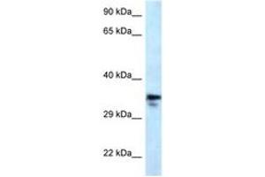 Image no. 1 for anti-Methylmalonic Aciduria (Cobalamin Deficiency) CblC Type, with Homocystinuria (MMACHC) (AA 190-239) antibody (ABIN6747634) (MMACHC Antikörper  (AA 190-239))